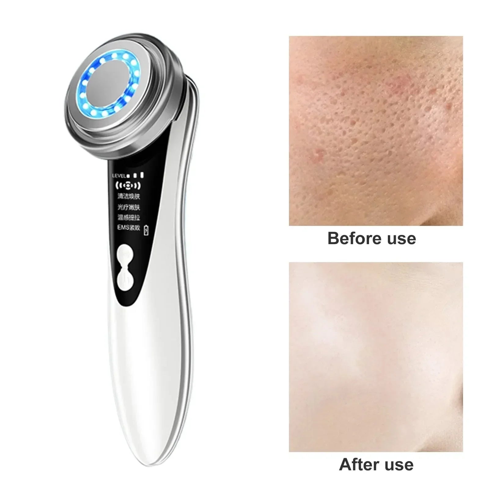 Ultra-Light Wireless Beauty Photon Skin Rejuvenation